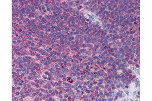 IHC Information: Paraffin embedded spleen tissue, tested with an antibody dilution of 5 ug/ml. (IFIH1 Antikörper  (Middle Region))