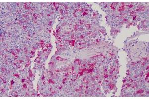 Immunohistochemistry (Formalin-fixed Paraffin-embedded Sections) (IHC (fp)) image for anti-Gelsolin (GSN) (AA 161-369) antibody (ABIN604886)