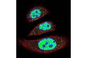 Immunofluorescence (IF) image for anti-tyrosyl-DNA phosphodiesterase 2 (TDP2) antibody (ABIN2996093) (TDP2 Antikörper)