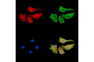 ABIN7095493 and ABIN7099550 staining Hela cells by IF/ICC. (Phosphoglucomutase 3 Antikörper)
