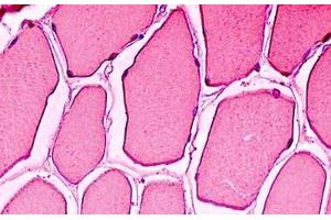 Human Skeletal Muscle: Formalin-Fixed, Paraffin-Embedded (FFPE) (Myoglobin Antikörper)