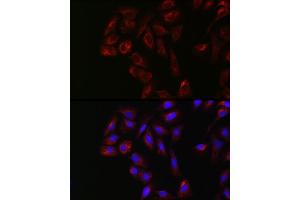 Immunofluorescence analysis of U2OS cells using YES1 Rabbit pAb (ABIN1683305, ABIN3015262, ABIN3015263 and ABIN6213907) at dilution of 1:250 (40x lens). (YES1 Antikörper  (AA 1-250))