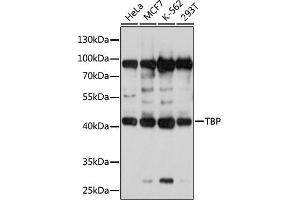 Western blot analysis of extracts of various cell lines, using TBP antibody (ABIN3023174, ABIN3023175, ABIN3023176 and ABIN1513589) at 1:1000 dilution. (TBP Antikörper  (AA 1-100))