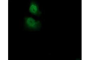 Anti-ADI1 mouse monoclonal antibody (ABIN2452702) immunofluorescent staining of COS7 cells transiently transfected by pCMV6-ENTRY ADI1 (RC200115). (ADI1 Antikörper)