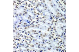 Immunohistochemistry of paraffin-embedded mouse kidney using Septin 7 antibody (ABIN1682655, ABIN3018092, ABIN3018093 and ABIN6220357) at dilution of 1:100 (40x lens).
