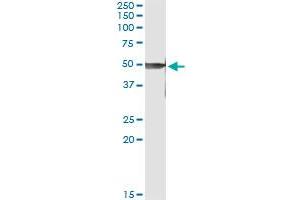 Immunoprecipitation of PRKX transfected lysate using anti-PRKX monoclonal antibody and Protein A Magnetic Bead , and immunoblotted with PRKX MaxPab rabbit polyclonal antibody. (PRKX Antikörper  (AA 269-358))