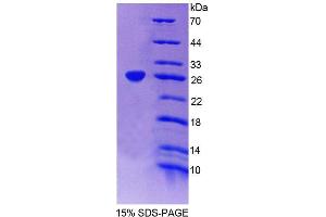 SDS-PAGE (SDS) image for Glutamyl-Prolyl-tRNA Synthetase (EPRS) (AA 749-956) protein (His tag) (ABIN6239235) (EPRS Protein (AA 749-956) (His tag))