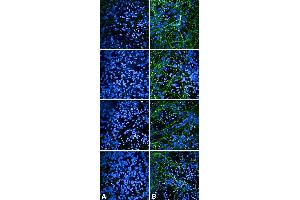 Immunocytochemistry/Immunofluorescence analysis using Rabbit Anti-Tau Monoclonal Antibody, Clone AH36 (ABIN6932902). (tau Antikörper  (pSer202, pThr205) (FITC))