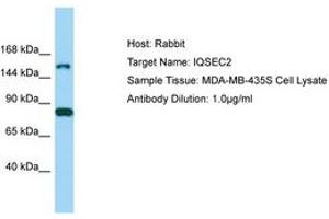 IQSEC2 Antikörper  (AA 351-400)