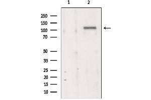 Western blot analysis of extracts from 293, using MKS3 antibody. (TMEM67 Antikörper  (Internal Region))