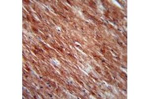 IL-2 antibody immunohistochemistry analysis in formalin fixed and paraffin embedded mouse heart tissue. (IL-2 Antikörper  (AA 50-77))