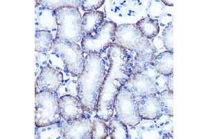 Immunohistochemistry of paraffin-embedded mouse kidney using EXTL3 Rabbit pAb (ABIN1679782, ABIN3018195, ABIN3018196 and ABIN6220395) at dilution of 1:100 (40x lens). (EXTL3 Antikörper  (AA 52-220))