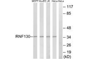 Western blot analysis of extracts from HeLa/Jurkat/HuvEc/MCF-7 cells, using RNF130 Antibody.