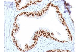 Formalin-fixed, paraffin-embedded human Prostate stained with FOXA1 Mouse Monoclonal Antibody (FOXA1/1512).