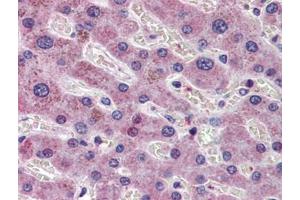Human Liver: Formalin-Fixed, Paraffin-Embedded (FFPE) (AIF Antikörper  (AA 593-606))
