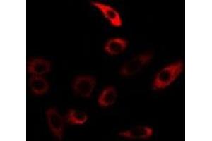 Immunofluorescent analysis of TGase5 staining in U2OS cells. (Transglutaminase 5 Antikörper)