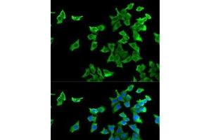 Immunofluorescence analysis of U2OS cells using HTR2B Polyclonal Antibody (Serotonin Receptor 2B Antikörper)