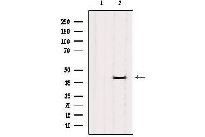 Western blot analysis of extracts from COS-7, using CXXC5 Antibody.