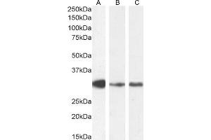 Western Blotting (WB) image for anti-Myeloid Differentiation Primary Response Gene (88) (MYD88) (Internal Region) antibody (ABIN185362)