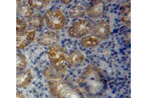 Used in DAB staining on fromalin fixed paraffin-embedded stomach tissue (Vinculin Antikörper  (AA 1020-1134))
