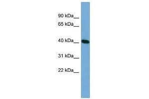 Western Blot showing TSSK2 antibody used at a concentration of 1-2 ug/ml to detect its target protein. (TSSK2 Antikörper  (Middle Region))