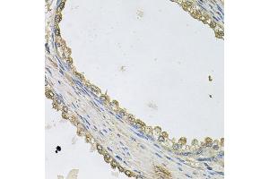 Immunohistochemistry of paraffin-embedded human prostate using MTERFD1 antibody.