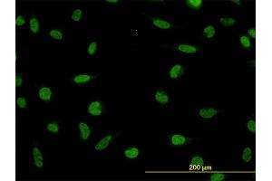 Immunofluorescence of monoclonal antibody to LDB2 on HeLa cell. (LIM Domain Binding 2 Protein Antikörper  (AA 1-373))