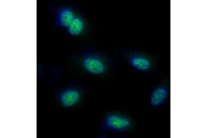 ICC/IF analysis of FUBP1 in HeLa cells line, stained with DAPI (Blue) for nucleus staining and monoclonal anti-human FUBP1 antibody (1:100) with goat anti-mouse IgG-Alexa fluor 488 conjugate (Green).