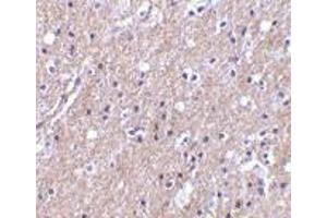 Immunohistochemistry (Paraffin-embedded Sections) (IHC (p)) image for anti-Complement C1q Tumor Necrosis Factor-Related Protein 6 (C1QTNF6) (Intermediate Domain) antibody (ABIN499679)