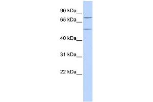 WB Suggested Anti-ZNF582 Antibody Titration:  0. (ZNF582 Antikörper  (N-Term))