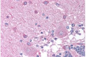 Immunohistochemistry (Paraffin-embedded Sections) (IHC (p)) image for anti-Cholinergic Receptor, Nicotinic, beta 2 (Neuronal) (CHRNB2) (AA 21-70) antibody (ABIN6736368)