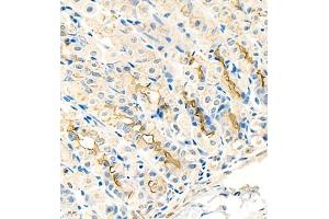 Immunohistochemistry (Paraffin-embedded Sections) (IHC (p)) image for anti-Keratin 13 (KRT13) (N-Term) antibody (ABIN7074412)