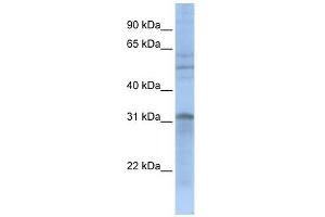 MTCH2 antibody used at 1 ug/ml to detect target protein. (MTCH2 Antikörper)