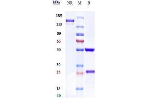 Anti-ROR1 Reference Antibody (zilovertamab) on SDS-PAGE under reducing (R) condition. (Rekombinanter ROR1 (Zilovertamab Biosimilar) Antikörper)