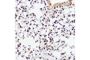 Immunohistochemistry of paraffin-embedded mouse lung using WBP11 Rabbit pAb (ABIN7271390) at dilution of 1:100 (40x lens).