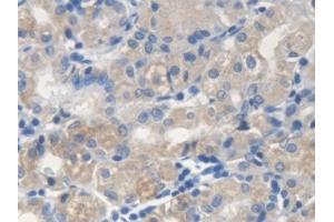 Detection of ME2 in Human Stomach Tissue using Polyclonal Antibody to Malic Enzyme 2, NADP+ Dependent, Mitochondrial (ME2) (Malic Enzyme 2, NADP+ Dependent, Mitochondrial (AA 220-426) Antikörper)