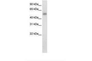 Image no. 2 for anti-Methyltransferase Like 3 (METTL3) (N-Term) antibody (ABIN202783) (METTL3 Antikörper  (N-Term))