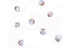 Immunocytochemistry of Aak1 in A-20 cells with AP30003PU-N Aak1 antibody at 5 μg/ml. (AAK1 Antikörper  (N-Term))