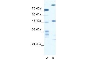 WB Suggested Anti-NFS1 Antibody Titration:  0. (NFS1 Antikörper  (Middle Region))