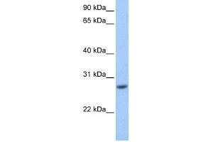 WB Suggested Anti-GSTM3 Antibody Titration: 0. (GSTM3 Antikörper  (Middle Region))