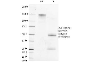 SDS-PAGE Analysis Purified AFP Mouse Monoclonal Antibody (MBS-12). (alpha Fetoprotein Antikörper)