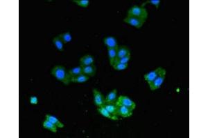 Immunofluorescent analysis of HepG2 cells using ABIN7174316 at dilution of 1:100 and Alexa Fluor 488-congugated AffiniPure Goat Anti-Rabbit IgG(H+L) (USP33 Antikörper  (C-Term))