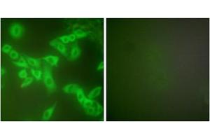 Immunofluorescence analysis of A549 cells, using Stefin B antibody (ABIN5976509). (CSTB Antikörper  (Internal Region))