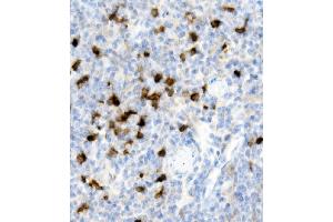 IHC analysis of Cd79a using anti-Cd79a antibody (ABIN7601110).