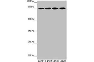 Western blot All lanes: LRSAM1 antibody at 2. (LRSAM1 Antikörper  (AA 1-290))