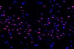 Immunofluorescent analysis of paraformaldehyde-fixed rat striatum using,TCOF1 (ABIN7076003) at dilution of 1: 1400 (TCOF1 Antikörper)