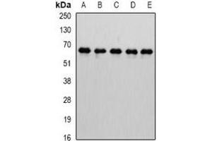 Western blot analysis of MTGR1 expression in Jurkat (A), HepG2 (B), mouse testis (C), mouse kidney (D), rat brain (E) whole cell lysates. (CBFA2T2 Antikörper)