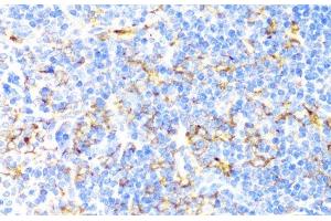 Immunohistochemistry of paraffin-embedded Mouse spleen using ITGAX Polyclonal Antibody at dilution of 1:100 (40x lens). (CD11c Antikörper)