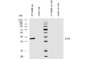 Western blotting analysis of human LIME using mouse monoclonal antibody LIME-10 on lysates of J77-LIME transfectants and Jurkat cells under reducing and non-reducing conditions. (LIME Antikörper  (AA 281-296))