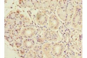 Immunohistochemistry of paraffin-embedded human pancreatic tissue using ABIN7147772 at dilution of 1:100 (CCDC108 Antikörper  (AA 2-164))